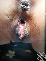 刚给老婆修的屄毛1