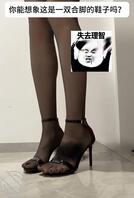 脚趾长穿凉鞋就这样吗？0