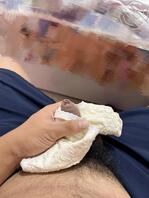 (原创)妹妹已经出院了!1