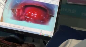 38 兄弟们!我恨啊,没做好措施导致妹妹怀孕了!而且宫颈糜烂!我该怎么办0