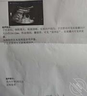 老婆怀孕了。医生说不让同房，有需求怎么办啊0