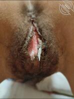 帮忙看下老婆的下面是处女么，是不是被干过