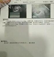 母狗想被爸爸们认出来，找到母狗，操坏母狗0