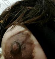 骚妈子宫癌晚期，拉回来扔床上了1