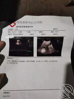 亲妹妹 29 我该如何处理跟我妹的这段感情?0