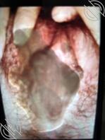 就喜欢自己照片被这样，怎么办??2