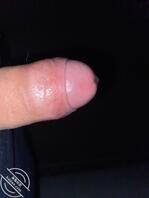 小鸡鸡10cm如何持久1