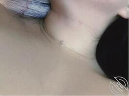 （31）给小妈胸上弄了好几个草莓，把小妈弄急眼了1