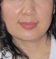 我妈爆瘦30斤的时候2