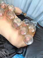 高挑美女来拔罐0