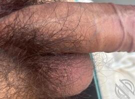 有没有小姐姐一起聊骚的呀，23岁哦