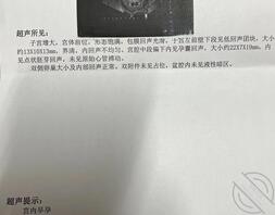 【真实原创】171、婶婶怀孕了，这个夏天突然感觉有些冷1