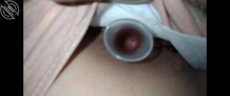 ⭕(原创)玩睡着亲妹妹的屁眼,把逼逼里的姨妈血捅出来了!!1