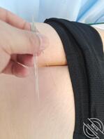 给女人扎针，饱眼福2