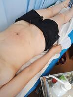 给女人扎针，饱眼福