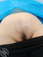 57岁老熟女扎逼2