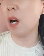 80年阿姨骚蝴蝶屄脱毛前后，有毛跟无毛的你更喜欢哪一款，评论区告诉阿姨
