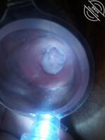 熟女骚妻的高清子宫，把她丝袜脱下来塞进她的子宫0