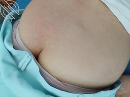 58岁护理部主任屁股真白0