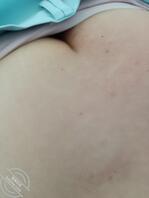 58岁护理部主任屁股真白2