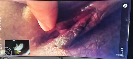 骚逼大学女友自慰1