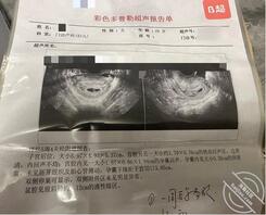 157. 老姐怀孕了，是谁的我们都不清楚。。1