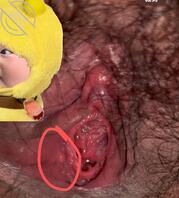 有医生吗，可以帮我看看吗，害怕1