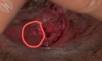 有医生吗，可以帮我看看吗，害怕2