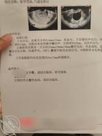 ［原创］听你们的建议内射老姐，结果把老姐干怀孕了0