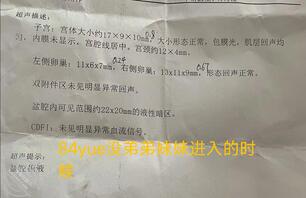 女儿的体检报告1