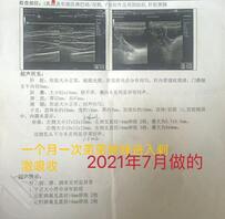 女儿的体检报告