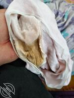 我妹好像被干出病了，逼里有分泌物把内裤都搞变色了还闻着味道好骚0